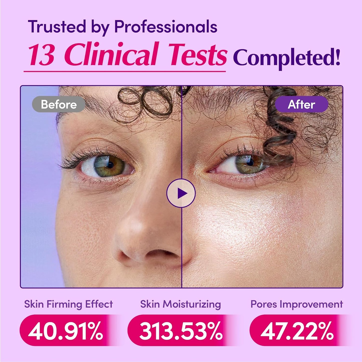 EQQUALBERRY  Plumping Serum – Retinol Alternative for Firm, Smooth Skin (30ml)